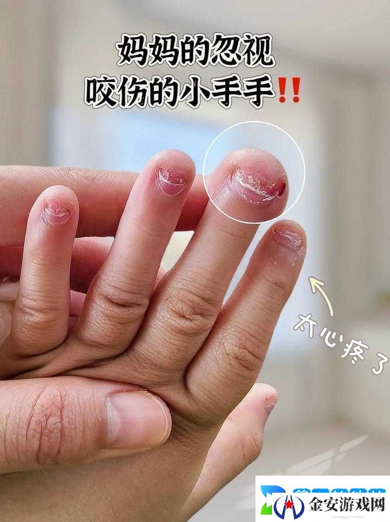 宝宝手指仅三根为何会如此疼痛引发关注