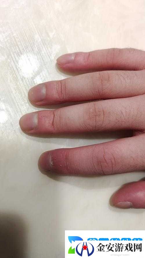 宝宝仅两根手指就疼哭了究竟是怎么回事呢