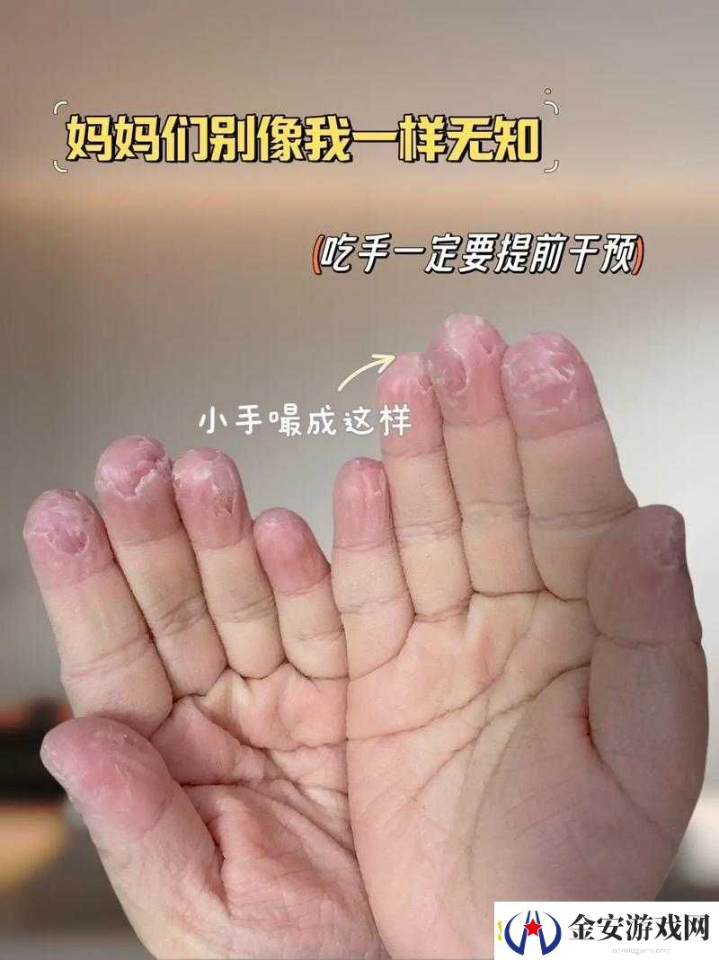 宝宝才两岁手指就已承受不住啦